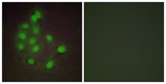 HAND1 Rabbit Polyclonal Antibody