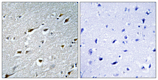 HAND1 Rabbit Polyclonal Antibody