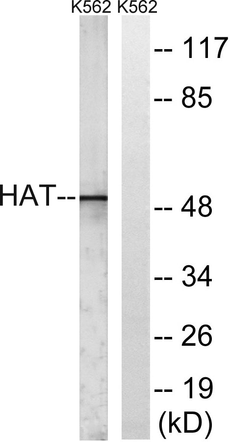 HAT1 Rabbit Polyclonal Antibody