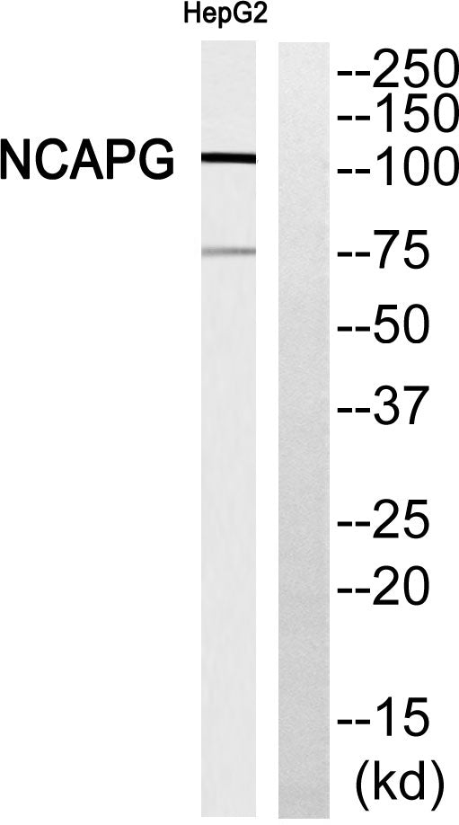hCAP-G Rabbit Polyclonal Antibody
