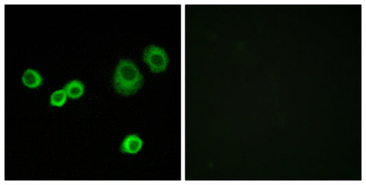 HCCS Rabbit Polyclonal Antibody