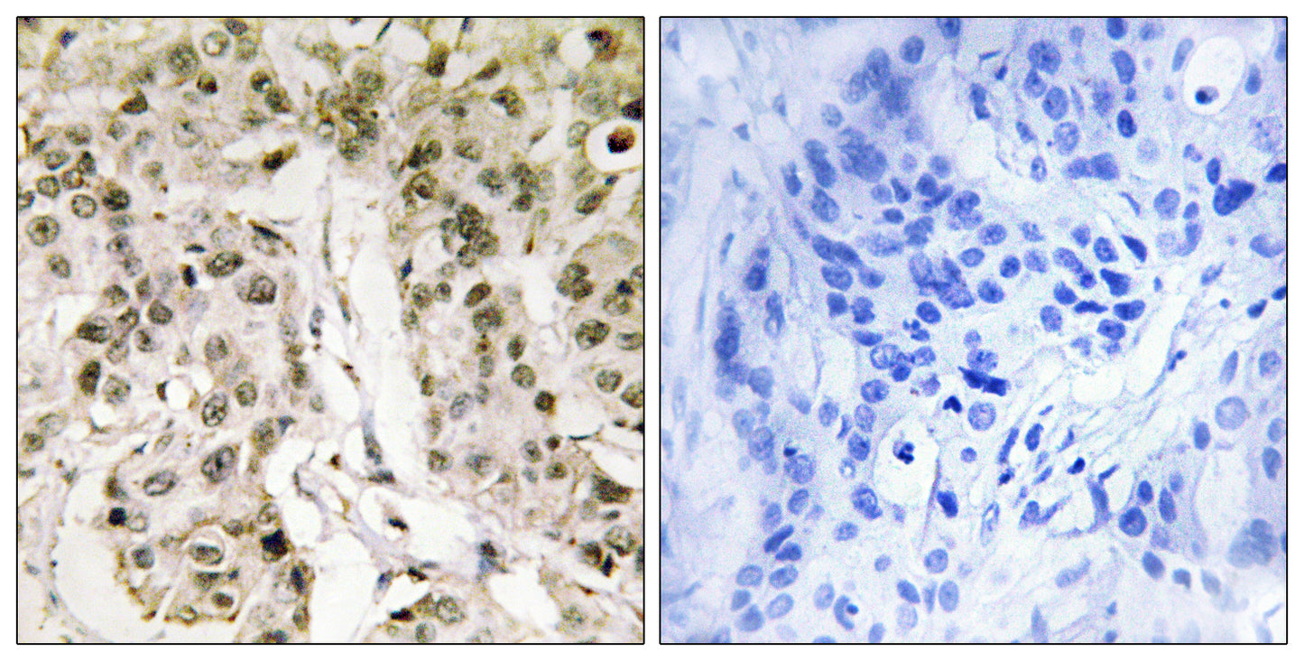 HCF1 Rabbit Polyclonal Antibody