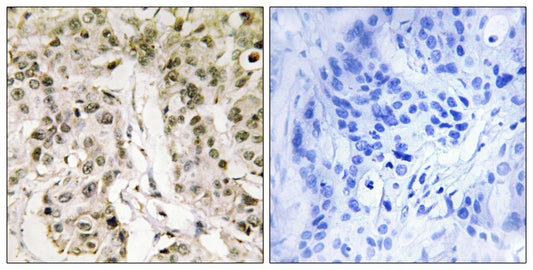 HCF1 Rabbit Polyclonal Antibody
