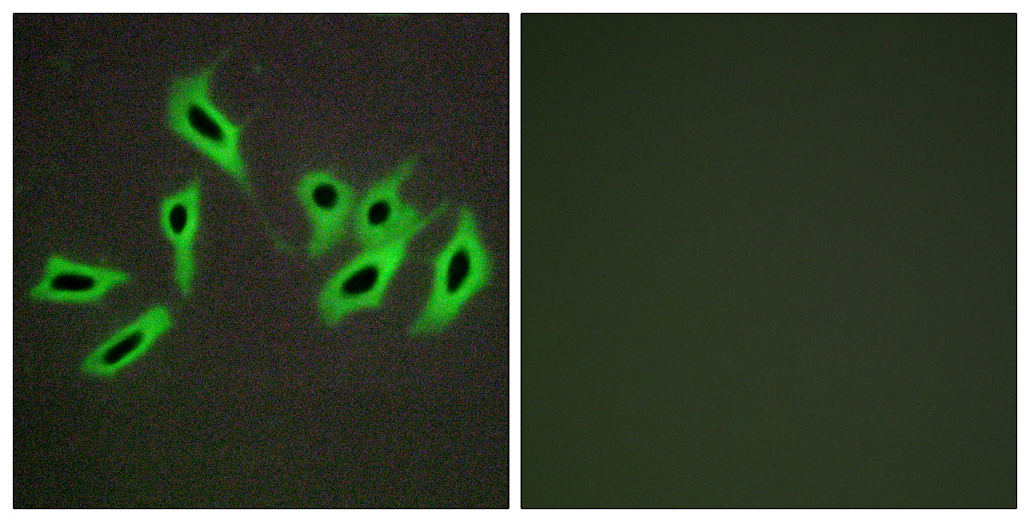 HC-II Rabbit Polyclonal Antibody