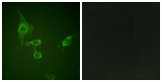 Hck Rabbit Polyclonal Antibody