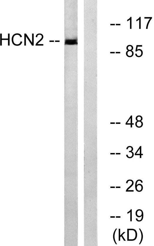 HCN2 Rabbit Polyclonal Antibody