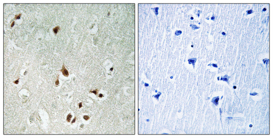 HDAC5/9 Rabbit Polyclonal Antibody