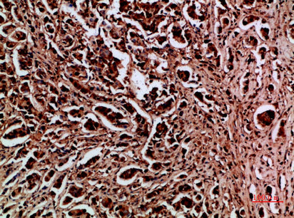 HDGF Rabbit Polyclonal Antibody
