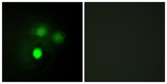 Hec1 Rabbit Polyclonal Antibody