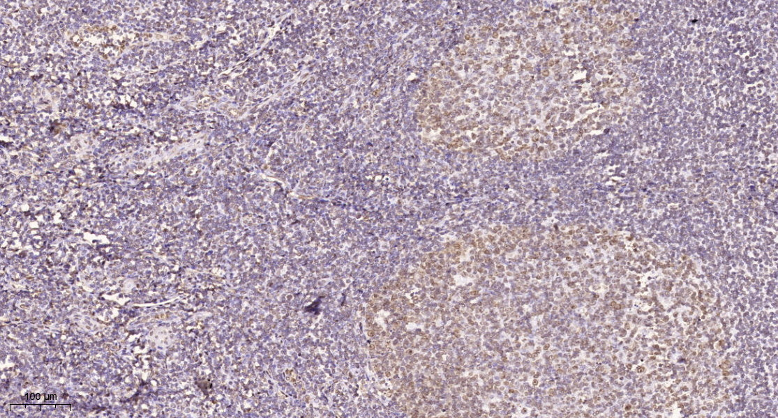 HECD1 Rabbit Polyclonal Antibody