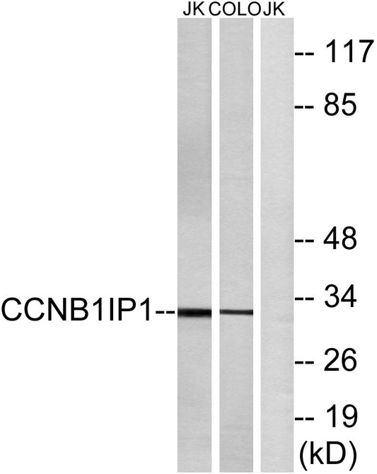 HEI10 Rabbit Polyclonal Antibody