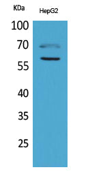 HEXA Rabbit Polyclonal Antibody