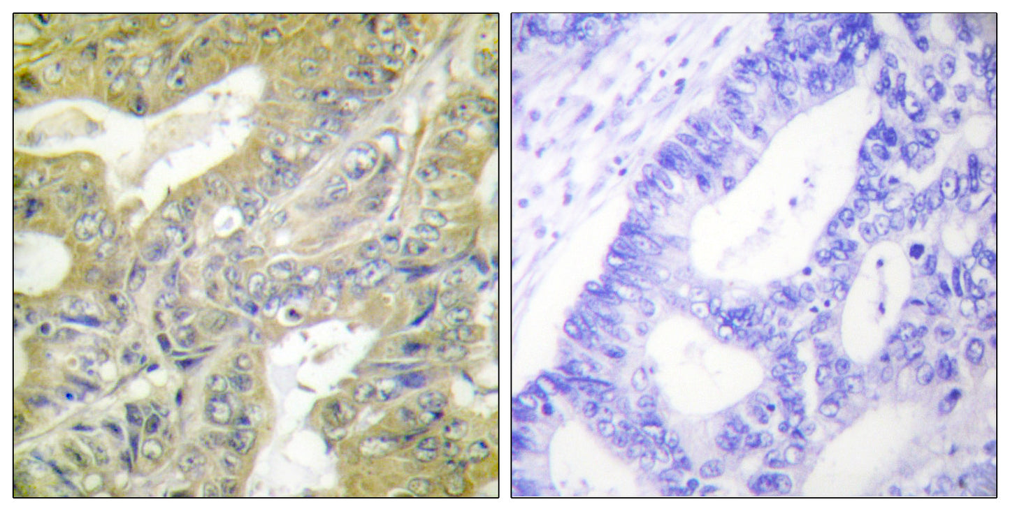 Hexb Rabbit Polyclonal Antibody
