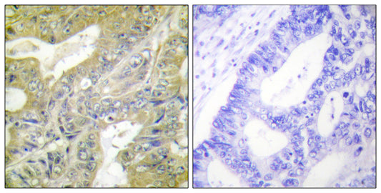 Hexb Rabbit Polyclonal Antibody