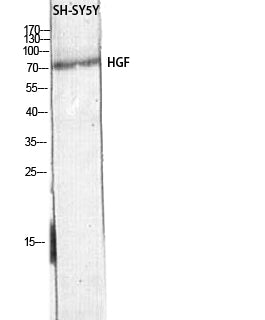 HGF Rabbit Polyclonal Antibody