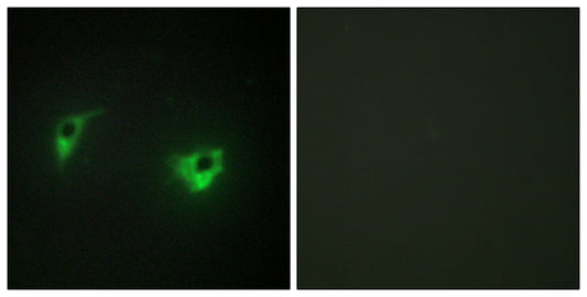 HGK Rabbit Polyclonal Antibody