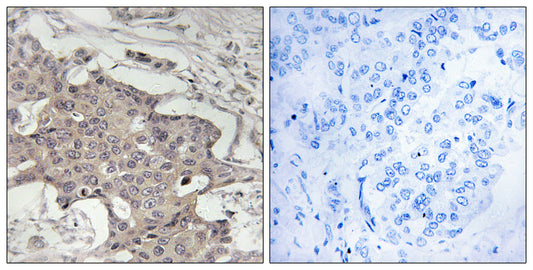 HIBADH Rabbit Polyclonal Antibody