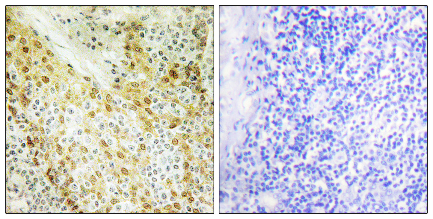HIRA Rabbit Polyclonal Antibody