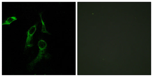 HisRS Rabbit Polyclonal Antibody