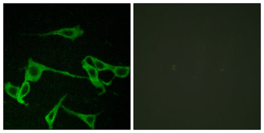 Histamine H2 Receptor Rabbit Polyclonal Antibody
