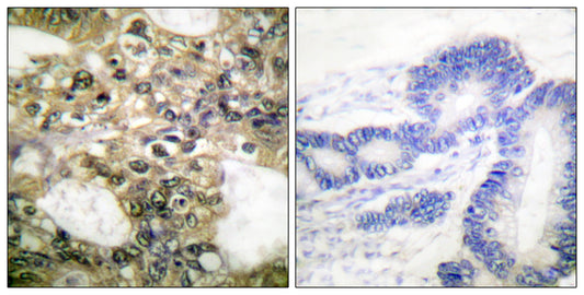 Histone deacetylase 6 Rabbit Polyclonal Antibody