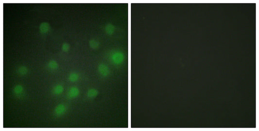 HKR1 Rabbit Polyclonal Antibody