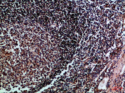 HLA-DMβ Rabbit Polyclonal Antibody