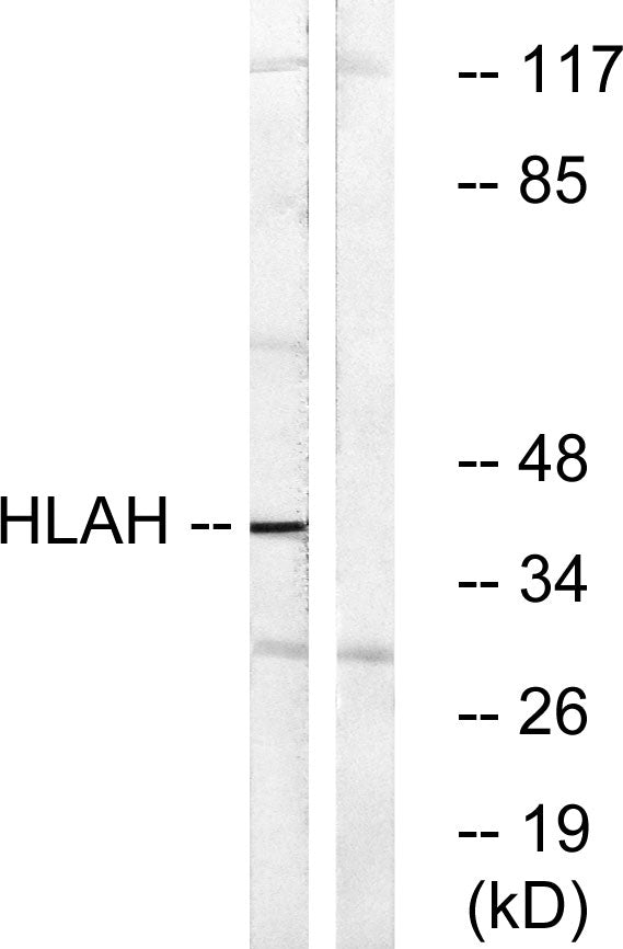 HLA-H Rabbit Polyclonal Antibody