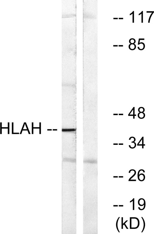 HLA-H Rabbit Polyclonal Antibody