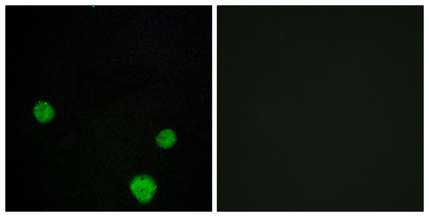 HLX1 Rabbit Polyclonal Antibody