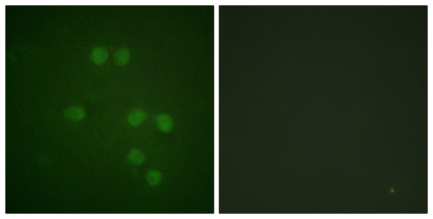 HMG-14 Rabbit Polyclonal Antibody