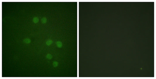HMG-14 Rabbit Polyclonal Antibody
