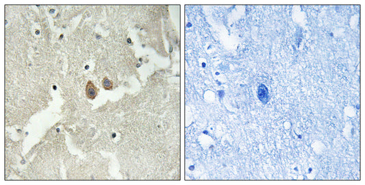 HMP19 Rabbit Polyclonal Antibody