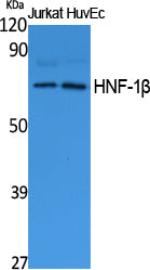 HNF-1β Rabbit Polyclonal Antibody