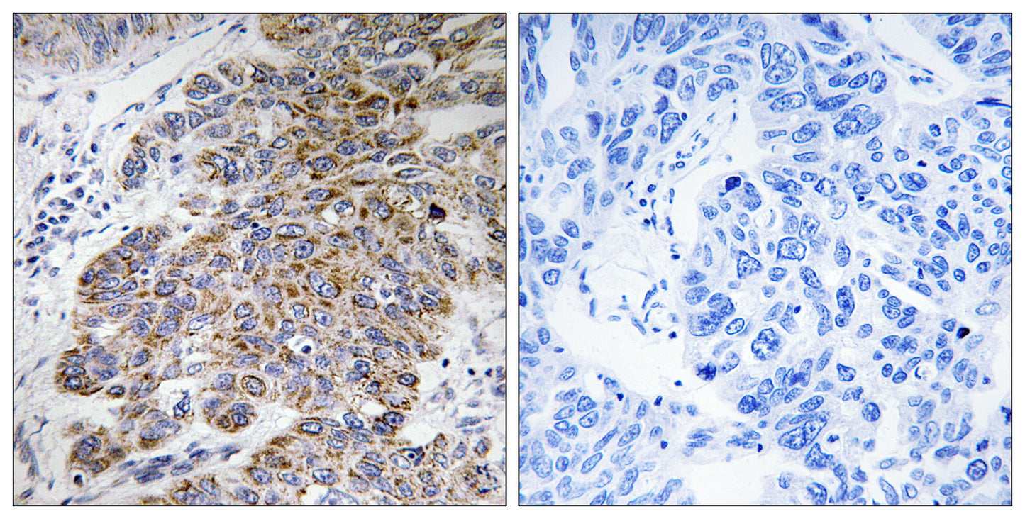 HNK-1ST Rabbit Polyclonal Antibody