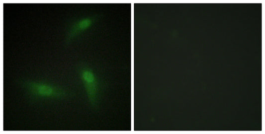 hnRNP A1 Rabbit Polyclonal Antibody