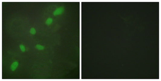 hnRNP A2/B1 Rabbit Polyclonal Antibody