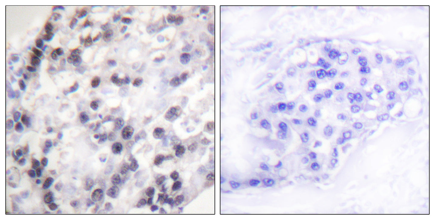 hnRNP C1/2 Rabbit Polyclonal Antibody