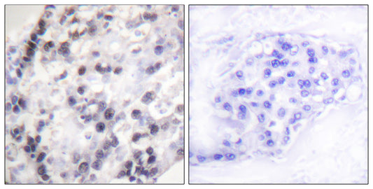 hnRNP C1/2 Rabbit Polyclonal Antibody