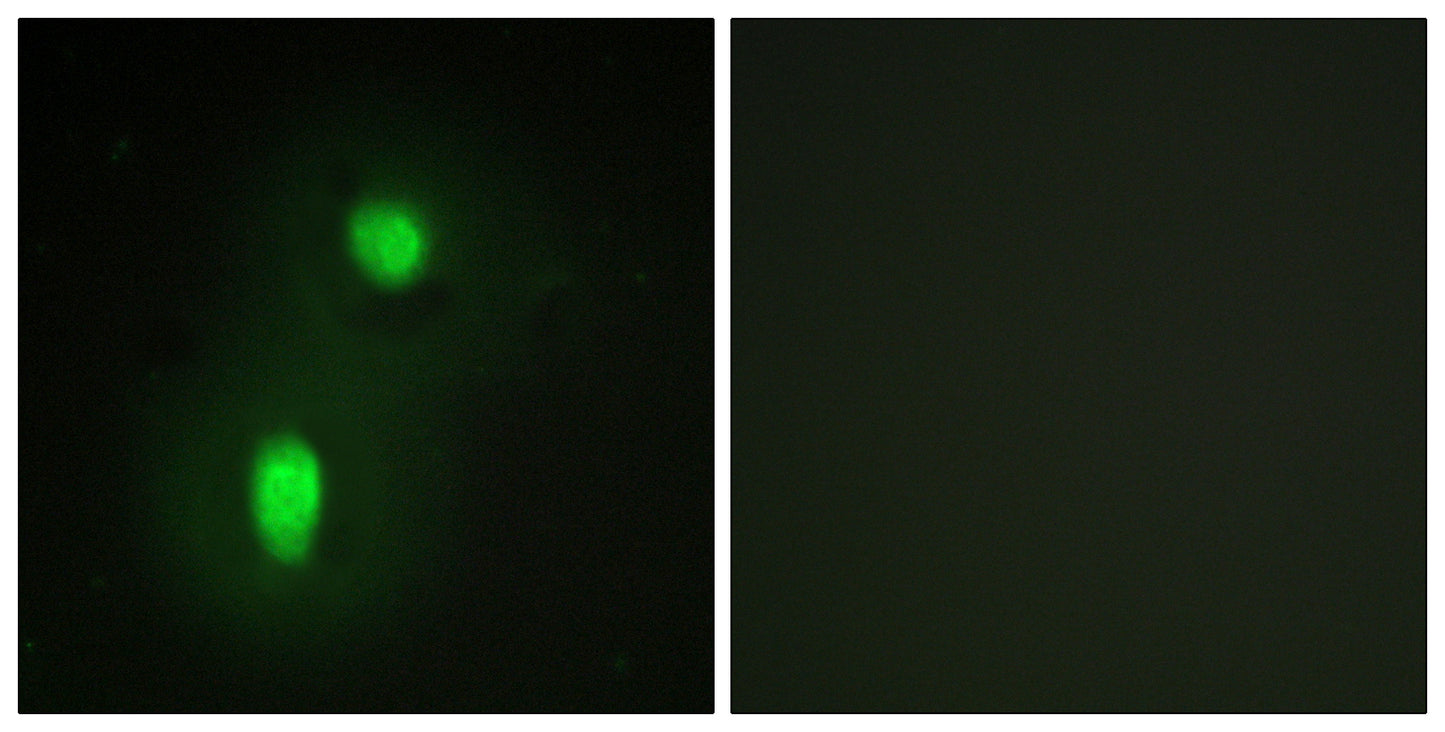 hnRNP C1/C2 Rabbit Polyclonal Antibody