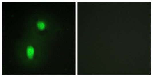 hnRNP C1/C2 Rabbit Polyclonal Antibody