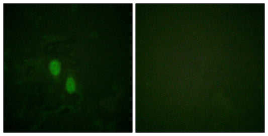 hnRNP D0 Rabbit Polyclonal Antibody