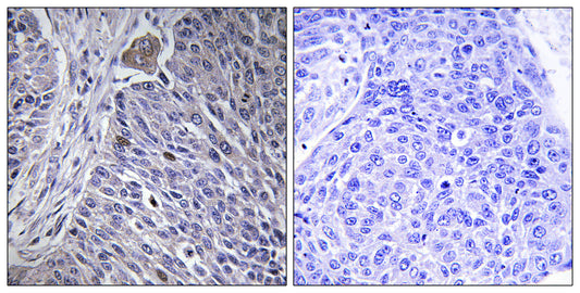 hnRNP DL Rabbit Polyclonal Antibody