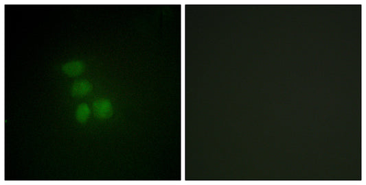 hnRNP G Rabbit Polyclonal Antibody
