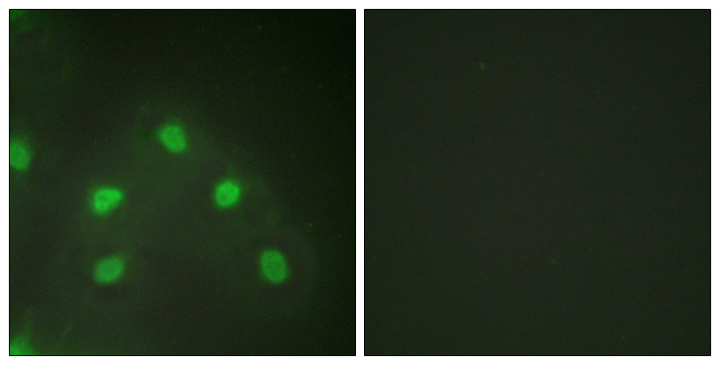 hnRNP L Rabbit Polyclonal Antibody