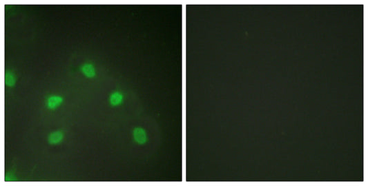 hnRNP L Rabbit Polyclonal Antibody