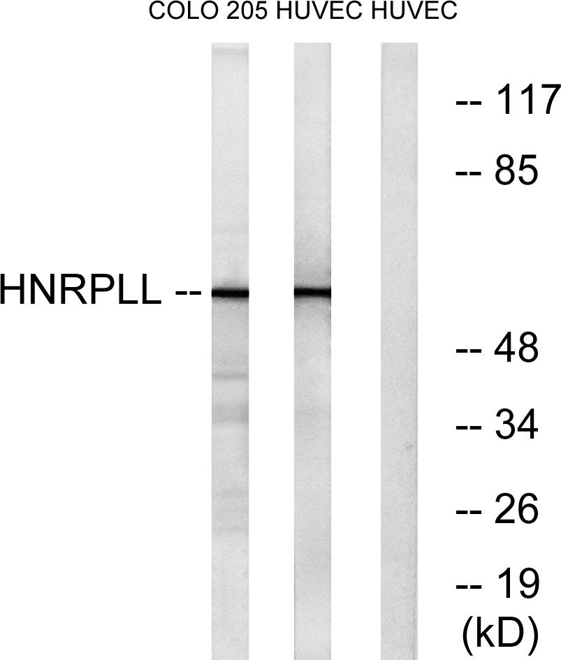hnRNP LL Rabbit Polyclonal Antibody