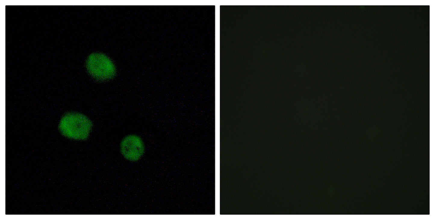 hnRNP M Rabbit Polyclonal Antibody