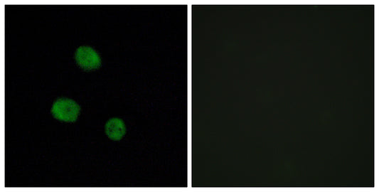 hnRNP M Rabbit Polyclonal Antibody