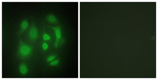 hnRNP Q Rabbit Polyclonal Antibody